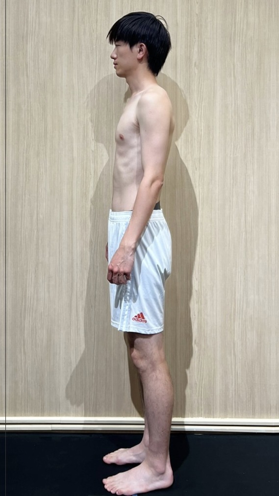 長時間久坐的建築師，站姿側面排列的變化 訓練前體態