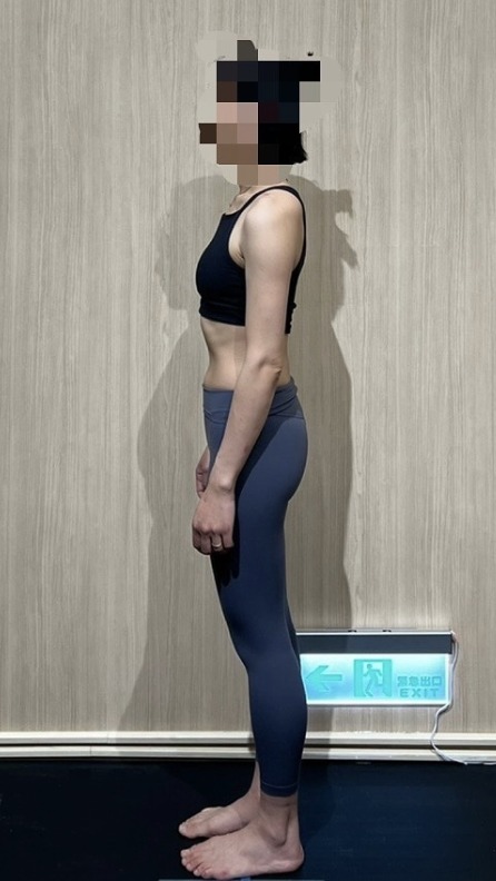 長時間久坐的醫師，站姿側面排列的變化 訓練前體態